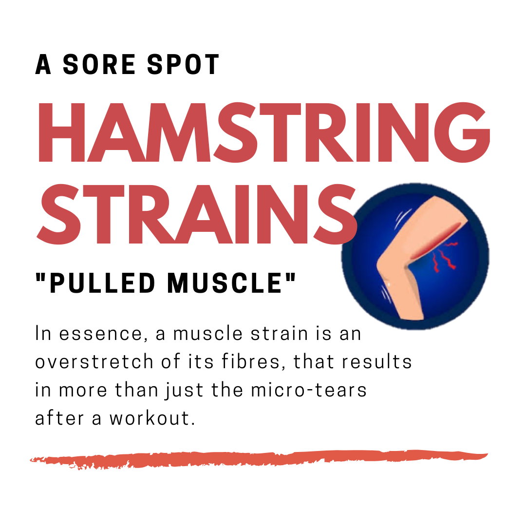 A Muscle Strain.png
